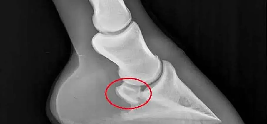 Schéma de la flexion de l'articulation interphalangienne distale